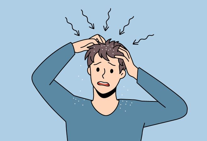 【首都除夕护卫健康】科普 脂溢性皮炎是怎么回事儿?