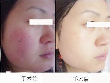 河南省人民医院